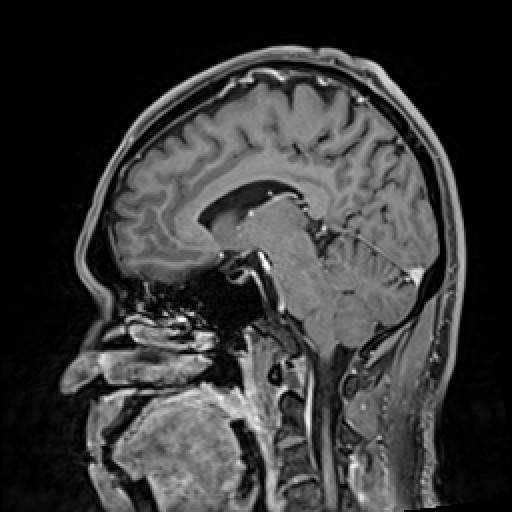 Click on the Serie image to view the images of VILLANUEVA, WILLIAM A.